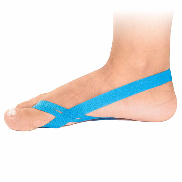 Fuß mit Hallufix Hammerzehen Loop